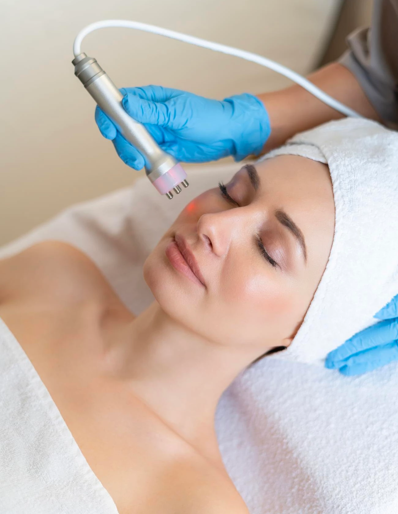 Microneedling