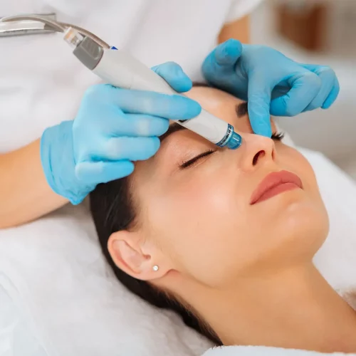 Hydrodermabrasion / Hydra Facial